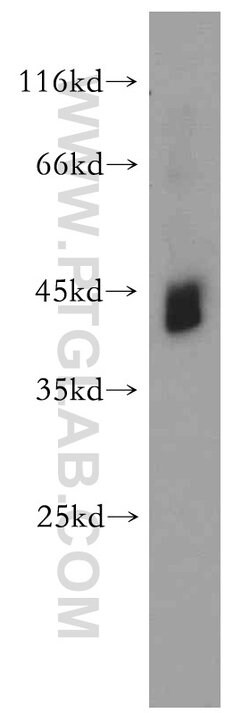 RNF150 Rabbit anti-Human, Mouse, Rat, Polyclonal, Proteintech 150 &mu;L;