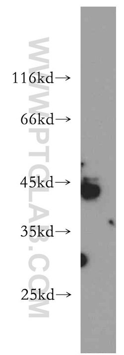 RNF150 Rabbit anti-Human, Mouse, Rat, Polyclonal, Proteintech 150 &mu;L;