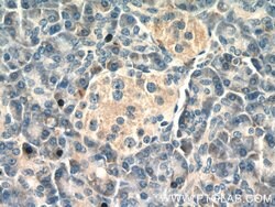DDRGK1 Rabbit anti-Human, Mouse, Polyclonal, Proteintech 150 &mu;L; Unconjugated:Antibodies,