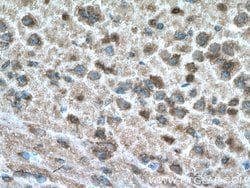 DDRGK1 Rabbit anti-Human, Mouse, Polyclonal, Proteintech 150 &mu;L; Unconjugated:Antibodies,