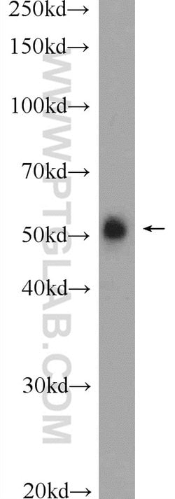 DDRGK1 Rabbit anti-Human, Mouse, Polyclonal, Proteintech 150 &mu;L; Unconjugated:Antibodies,