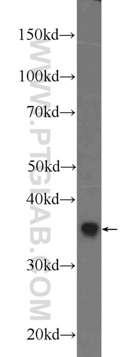 DDRGK1 Rabbit anti-Human, Mouse, Polyclonal, Proteintech 150 &mu;L; Unconjugated:Antibodies,