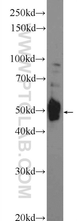 DDRGK1 Rabbit anti-Human, Mouse, Polyclonal, Proteintech 150 &mu;L; Unconjugated:Antibodies,