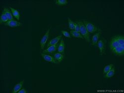 PRH1 Rabbit anti-Human, Polyclonal, Proteintech:Antibodies:Primary Antibodies