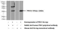 PRH1 Rabbit anti-Human, Polyclonal, Proteintech:Antibodies:Primary Antibodies