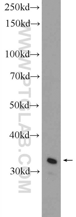 C21orf59 Rabbit anti-Human, Polyclonal, Proteintech:Antibodies:Primary