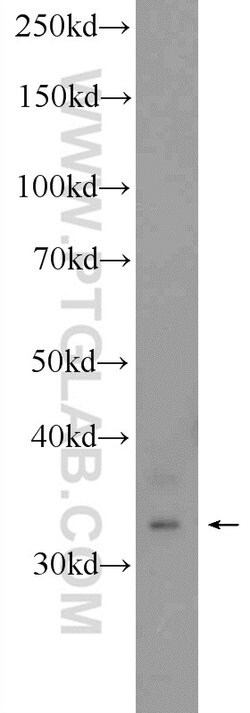 C21orf59 Rabbit anti-Human, Polyclonal, Proteintech:Antibodies:Primary