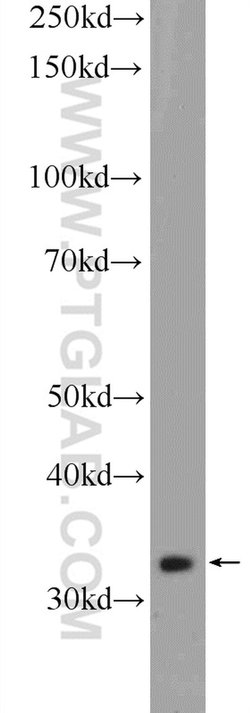 C21orf59 Rabbit anti-Human, Polyclonal, Proteintech:Antibodies:Primary