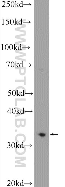 C21orf59 Rabbit anti-Human, Polyclonal, Proteintech:Antibodies:Primary