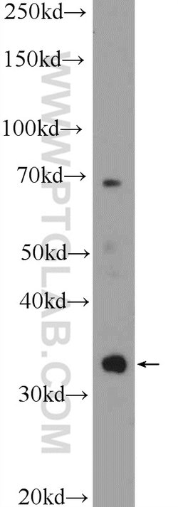 C21orf59 Rabbit anti-Human, Polyclonal, Proteintech:Antibodies:Primary