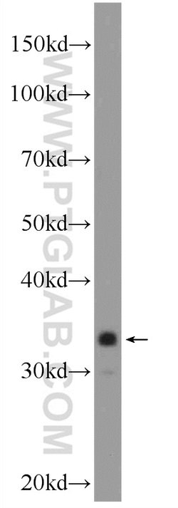 C21orf59 Rabbit anti-Human, Polyclonal, Proteintech:Antibodies:Primary