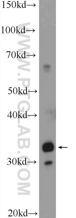 C21orf59 Rabbit anti-Human, Polyclonal, Proteintech:Antibodies:Primary