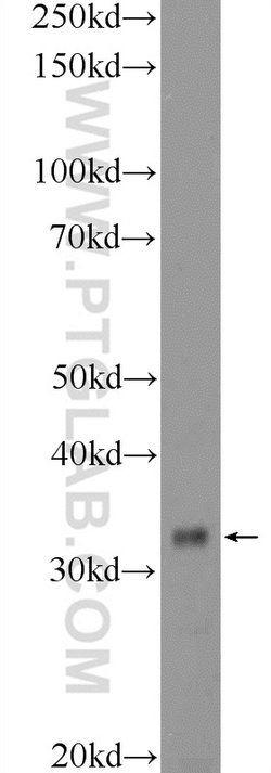 C21orf59 Rabbit anti-Human, Polyclonal, Proteintech:Antibodies:Primary