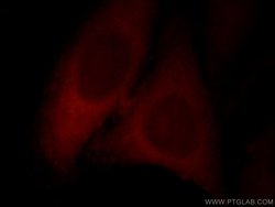 SYNPO2L Rabbit anti-Human, Mouse, Rat, Polyclonal, Proteintech 150 μL;