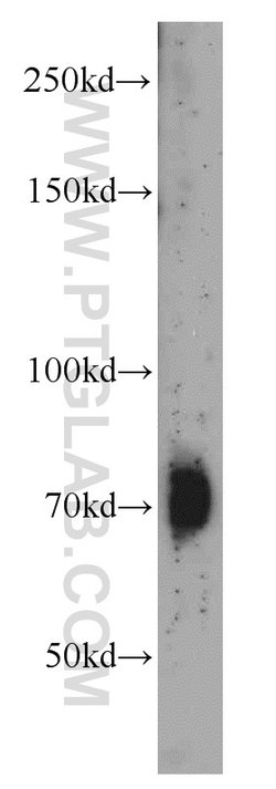 SYNPO2L Rabbit anti-Human, Mouse, Rat, Polyclonal, Proteintech 150 μL;