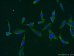 MAGEC3 Rabbit anti-Human, Mouse, Polyclonal, Proteintech 150 &mu;L; Unconjugated:Antibodies,