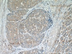 MAGEC3 Rabbit anti-Human, Mouse, Polyclonal, Proteintech 150 &mu;L; Unconjugated:Antibodies,