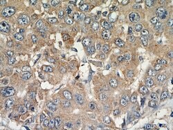 MAGEC3 Rabbit anti-Human, Mouse, Polyclonal, Proteintech 150 &mu;L; Unconjugated:Antibodies,