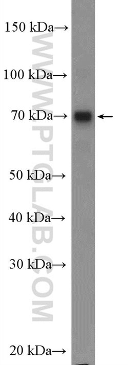 MAGEC3 Rabbit anti-Human, Mouse, Polyclonal, Proteintech 150 &mu;L; Unconjugated:Antibodies,