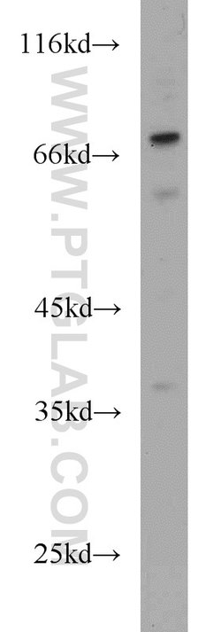 MAGEC3 Rabbit anti-Human, Mouse, Polyclonal, Proteintech 150 &mu;L; Unconjugated:Antibodies,
