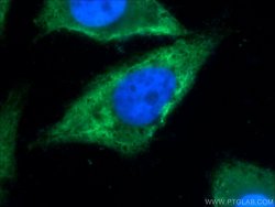 TXNDC16 Rabbit anti-Human, Polyclonal, Proteintech 150 &mu;L | Buy Online | Proteintech Group Inc | Fisher Scientific