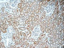 TXNDC16 Rabbit anti-Human, Polyclonal, Proteintech 150 &mu;L | Buy Online | Proteintech Group Inc | Fisher Scientific