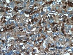 TXNDC16 Rabbit anti-Human, Polyclonal, Proteintech 150 &mu;L | Buy Online | Proteintech Group Inc | Fisher Scientific