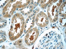 TXNDC16 Rabbit anti-Human, Polyclonal, Proteintech 150 &mu;L | Buy Online | Proteintech Group Inc | Fisher Scientific