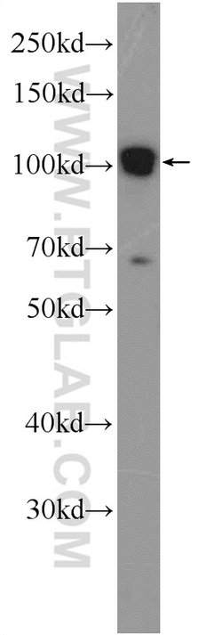 TXNDC16 Rabbit anti-Human, Polyclonal, Proteintech 150 &mu;L | Buy Online | Proteintech Group Inc | Fisher Scientific
