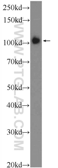 TXNDC16 Rabbit anti-Human, Polyclonal, Proteintech 150 &mu;L | Buy Online | Proteintech Group Inc | Fisher Scientific