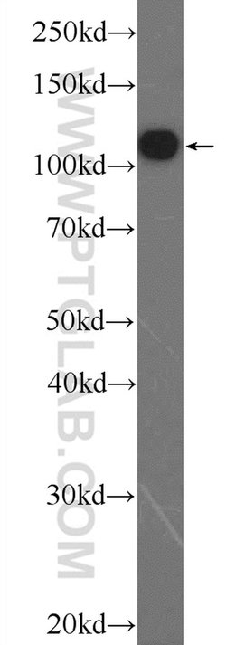TXNDC16 Rabbit anti-Human, Polyclonal, Proteintech 150 &mu;L | Buy Online | Proteintech Group Inc | Fisher Scientific