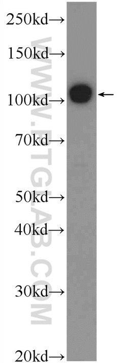 TXNDC16 Rabbit anti-Human, Polyclonal, Proteintech 150 &mu;L | Buy Online | Proteintech Group Inc | Fisher Scientific