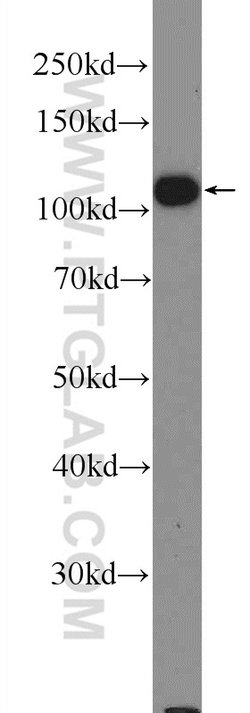 TXNDC16 Rabbit anti-Human, Polyclonal, Proteintech 150 &mu;L | Buy Online | Proteintech Group Inc | Fisher Scientific