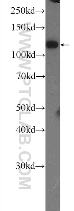 TXNDC16 Rabbit anti-Human, Polyclonal, Proteintech 150 &mu;L | Buy Online | Proteintech Group Inc | Fisher Scientific