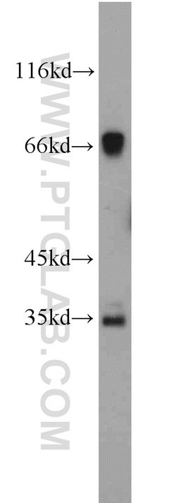 C19orf44 Rabbit anti-Human, Mouse, Rat, Polyclonal, Proteintech 150 &mu;L | Buy Online | Proteintech Group Inc | Fisher Scientific