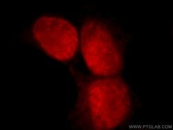 C1orf106 Rabbit anti-Human, Mouse, Rat, Polyclonal, Proteintech 150 &mu;L;