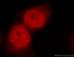 C1orf106 Rabbit anti-Human, Mouse, Rat, Polyclonal, Proteintech 150 &mu;L;