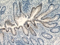 C1orf106 Rabbit anti-Human, Mouse, Rat, Polyclonal, Proteintech 150 &mu;L;