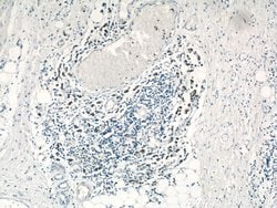 C1orf106 Rabbit anti-Human, Mouse, Rat, Polyclonal, Proteintech 150 &mu;L;