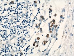 C1orf106 Rabbit anti-Human, Mouse, Rat, Polyclonal, Proteintech 150 &mu;L;