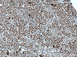 C1orf106 Rabbit anti-Human, Mouse, Rat, Polyclonal, Proteintech 150 &mu;L;