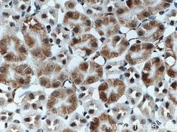 C1orf106 Rabbit anti-Human, Mouse, Rat, Polyclonal, Proteintech 150 &mu;L;