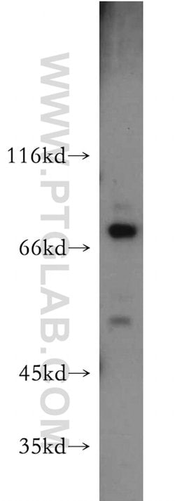 C1orf106 Rabbit anti-Human, Mouse, Rat, Polyclonal, Proteintech 150 &mu;L;