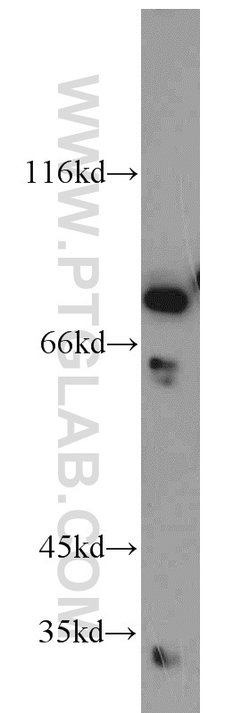 C1orf106 Rabbit anti-Human, Mouse, Rat, Polyclonal, Proteintech 150 &mu;L;
