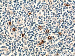 KLRF1 Rabbit anti-Human, Polyclonal, Proteintech 150 &mu;L; Unconjugated:Antibodies,