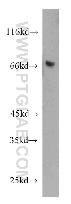 KLRF1 Rabbit anti-Human, Polyclonal, Proteintech 150 &mu;L; Unconjugated:Antibodies,