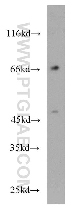 KLRF1 Rabbit anti-Human, Polyclonal, Proteintech 150 &mu;L; Unconjugated:Antibodies,