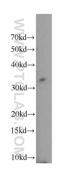 TNFRSF13B Rabbit anti-Human, Polyclonal, Proteintech:Antibodies:Primary