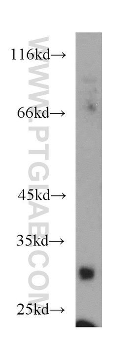 TNFRSF13B Rabbit anti-Human, Polyclonal, Proteintech:Antibodies:Primary
