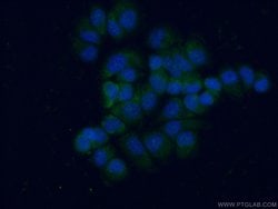 L1TD1 Rabbit anti-Human, Polyclonal, Proteintech 150 &mu;L; Unconjugated:Antibodies,